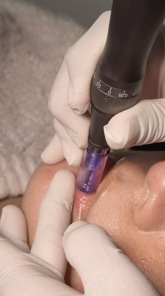 HIDRALIPS CON PINK GLOW  Brillo natural con 55 activos  Agenda aquí